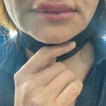 Med Dent's Manavgat Baskı İle İşlem Yapılıyor!