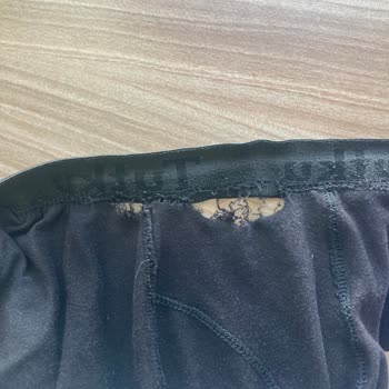 Külotlarda Lastik Ayrılması Sorunu ve Çözüm Talebi