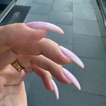 Hijyen Sorunu Ve Beklenmeyen Ek Ücretlerle Mağduriyet Yaşadım