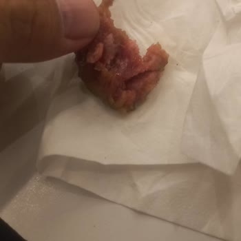 Köfte Siparişim Ya Tam Pişmedi Ya Da Fazla Pişirildi, Mağduriyet Yaşıyorum