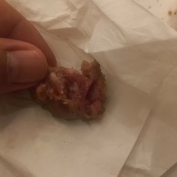 Köfte Siparişim Ya Tam Pişmedi Ya Da Fazla Pişirildi, Mağduriyet Yaşıyorum