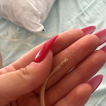 Saç Kaynağı İşleminde Kalitesiz Hizmet Ve Müşteri Mağduriyeti