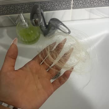 Saç Kaynağı İşleminde Kalitesiz Hizmet Ve Müşteri Mağduriyeti