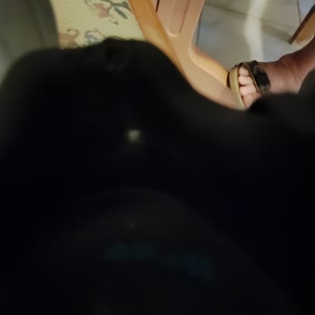 Garanti Dışı Bırakılan Skechers Ayakkabıda Kırılma Ve Jel Patlaması Sorunu