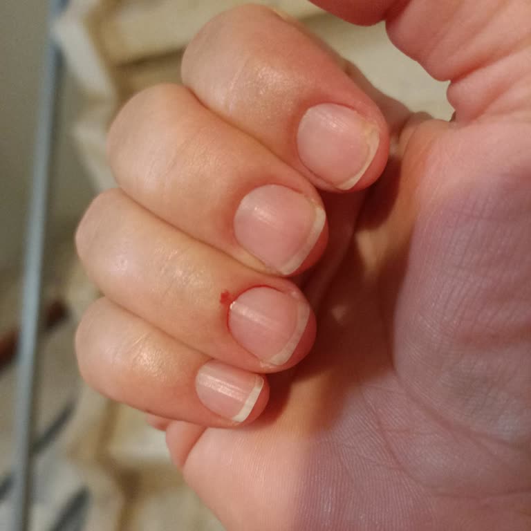 Mda Nail Bar Beauty Center Mağduriyeti