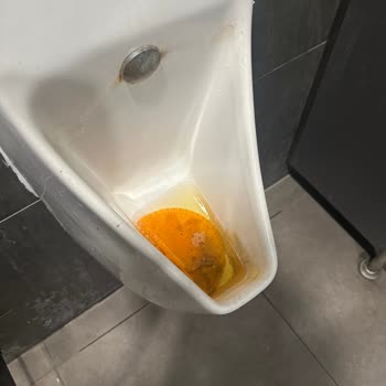 İstasyon Tuvaletlerinde Sürekli Hijyen Sorunu Ve Kötü Koku