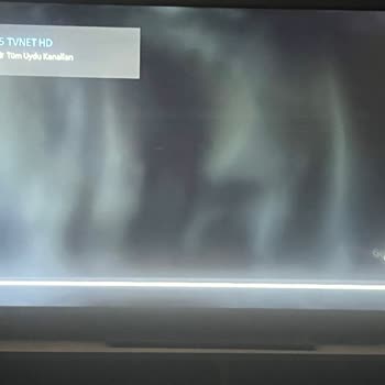 Philips Televizyonda Işık Süzmeleri Ve Servis Süreci Sorunu