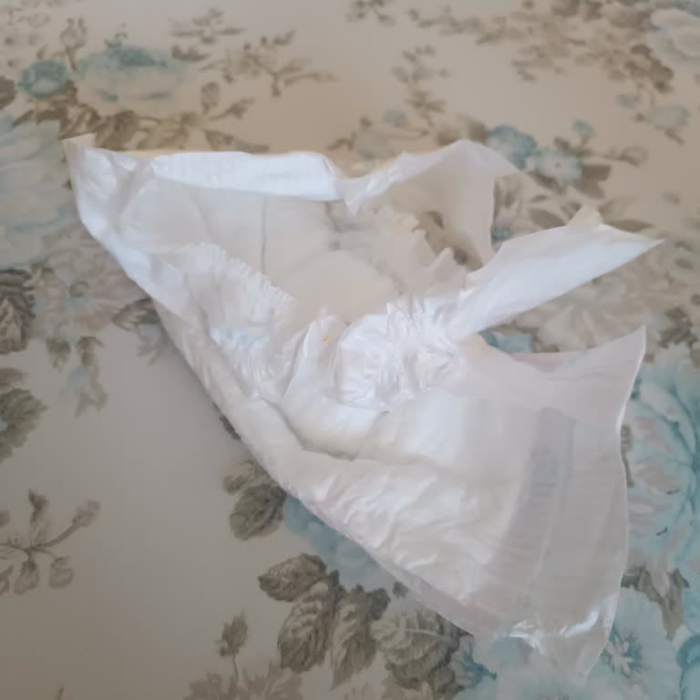 Molfix 4 Numara Bebek Bezinde Defolu Ürün Sorunu Ve Mağduriyet