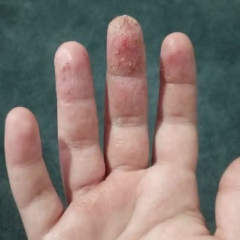 Cildiye Bölümünde İlgisizlik Ve Yetersiz Hizmet