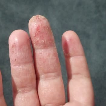 Cildiye Bölümünde İlgisizlik Ve Yetersiz Hizmet