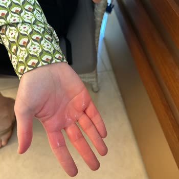 Otelin İlgisizliği Ve Çözüm Sunmaması Tatilimizi Mahvetti