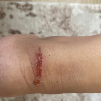 Aldığımız Babet Annemin Ayağını Yaraladı, Mağaza Çözüm Sunmadı