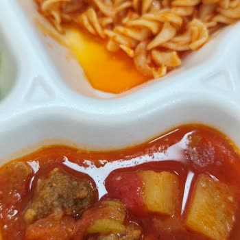 Hastanede Sürekli Tatsız Ve Yağlı Yemekler İştahımı Kapattı