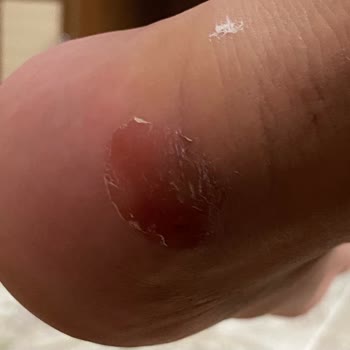 Aldığım Puma Ayakkabı Ayağımı Yaraladı, Mağaza Çözüm Sunmuyor