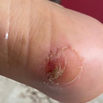 Aldığım Puma Ayakkabı Ayağımı Yaraladı, Mağaza Çözüm Sunmuyor