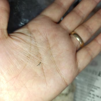 Pişmaniyeden Çıkan Tel Çocuğumun Sağlığını Tehlikeye Attı