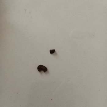 Şenöz Coffee'yi İçerken Ağzıma Sert Cisimler Geliyor!