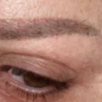 Kaş Uygulamasında Simetri Hataları Ve Yanıltıcı İşlem Bilgilendirmesi