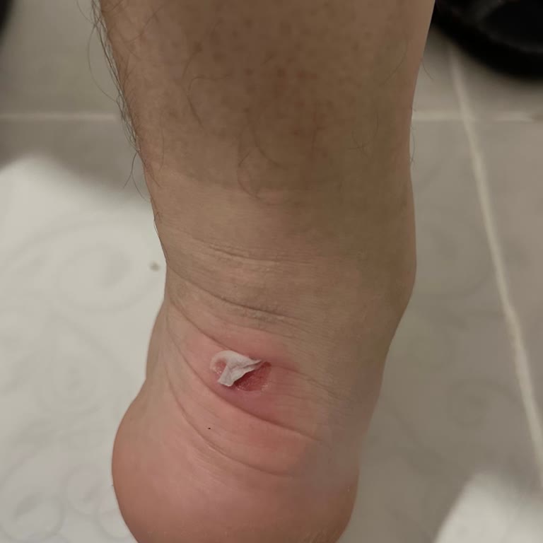 Kısa Sürede Hasar Gören Ayakkabı İçin Çözüm Bekliyorum