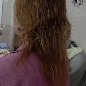 Kuaförde Saçım Yandı, Mağduriyetim Giderilmiyor!