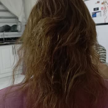 Kuaförde Saçım Yandı, Mağduriyetim Giderilmiyor!