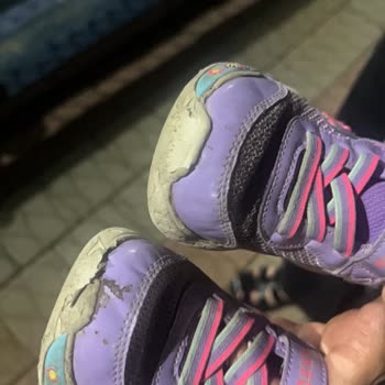 Skechers Çocuk Ayakkabısı Kısa Sürede Paramparça Oldu, İade Talebim Reddedildi