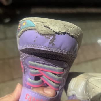 Skechers Çocuk Ayakkabısı Kısa Sürede Paramparça Oldu, İade Talebim Reddedildi