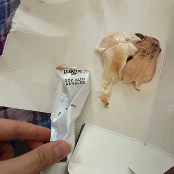 Küflü Saç Boyası Sonrası Alerjik Reaksiyon Ve Yetersiz Müşteri Hizmeti Deneyimi