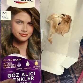 Küflü Saç Boyası Sonrası Alerjik Reaksiyon Ve Yetersiz Müşteri Hizmeti Deneyimi