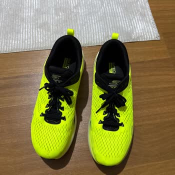 6600 TL’lik Ayakkabı 20 Kez Giyince Yırtıldı, Skechers Çözüm Sunmadı