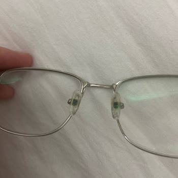 Kısa Sürede Oksitlenen Gözlük Kaşıntı Ve Çözüm Eksikliği