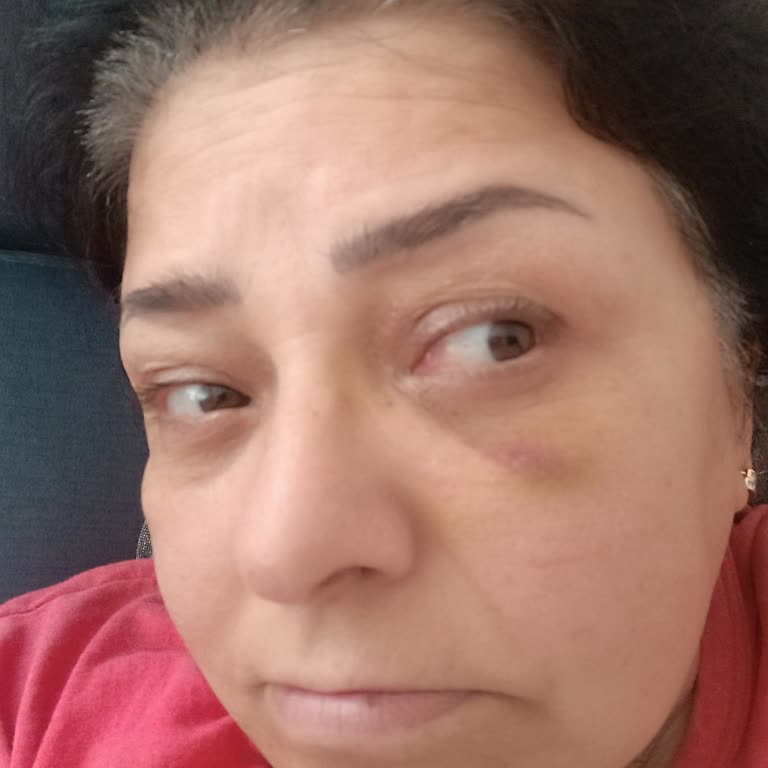 Hizmet Almadan Tahsil Edilen 1400 TL Ve İlgisiz Acil Servis