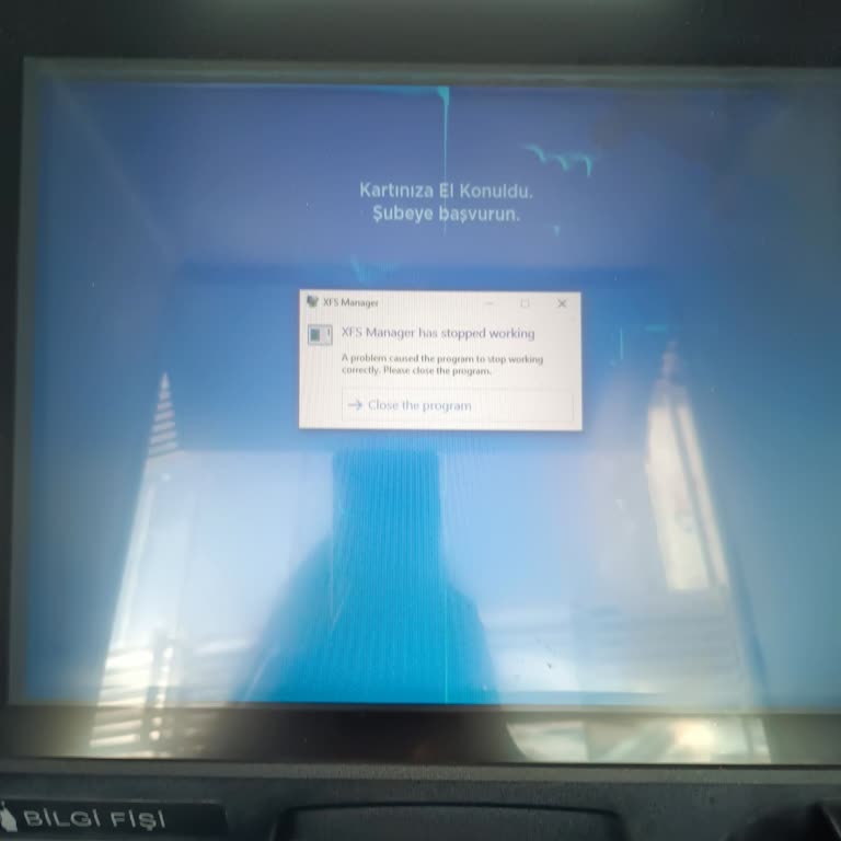 ATM Hem Paramı Hem Kartımı Yuttu, Mağdur Edildim!