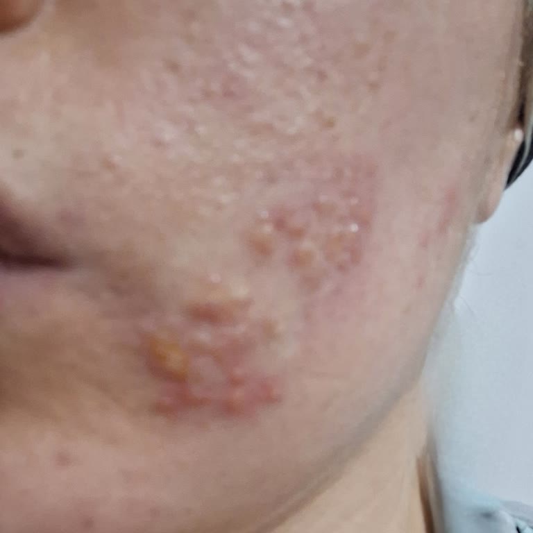 Trendyol Dr.Algler Satıcı Şikayeti!