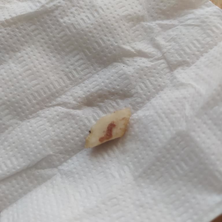 Domino's Pizza'da Pizzadan Kemik Çıkması Ve Yetersiz Müşteri Hizmeti