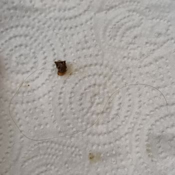 Hazır Gıda Ürününde Hijyen Sorunu ve Yabancı Madde Şikayeti