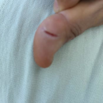 Karaca Dayanıksız Cam French Press Ciddi Yaralanmaya Sebep Oldu