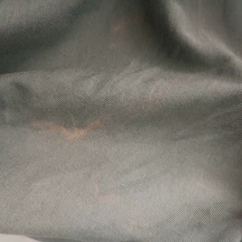 Abdi İbrahim Clozaril Jel Kullanımı Sonrası Tişörtlerimde Kalıcı Leke Oluştu