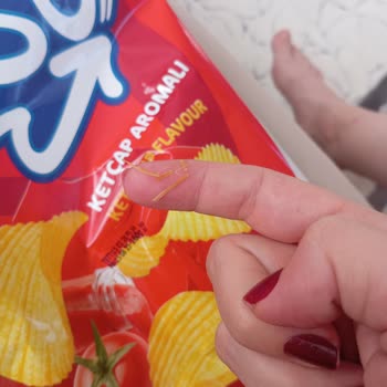 Cipso Cipsin İçinden Çıkan Yabancı Madde Sağlığımı Tehlikeye Attı