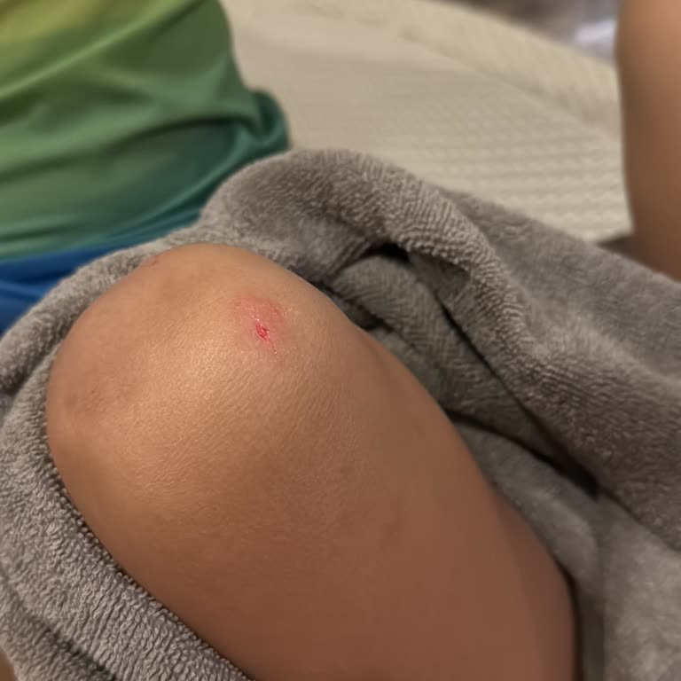 Gönen Hotels Havuzda Ciddi Bir Güvenlik Sorunu Yaşadık