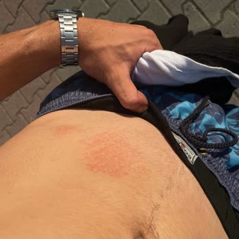 Onvo RX5 Scooter'da Ani Hız Kesmede Tehlikeli Sallanma Ve Kaza Riski