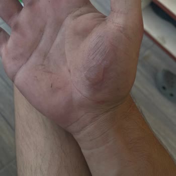 Onvo RX5 Scooter'da Ani Hız Kesmede Tehlikeli Sallanma Ve Kaza Riski