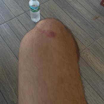 Onvo RX5 Scooter'da Ani Hız Kesmede Tehlikeli Sallanma Ve Kaza Riski