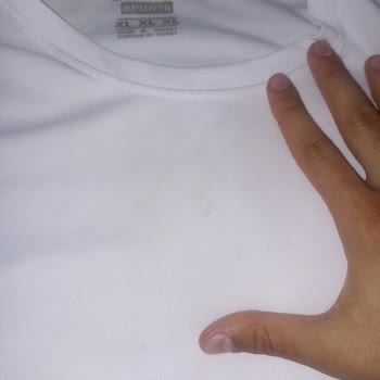 Satın Aldığım Spor T-shirt Setinde Leke Ve Koku Problemi Yaşıyorum