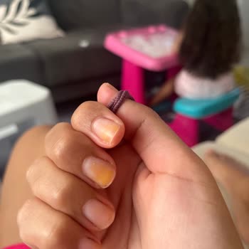 Flormar Oje Tırnaklarımda Kalıcı Sarılığa Sebep Oldu