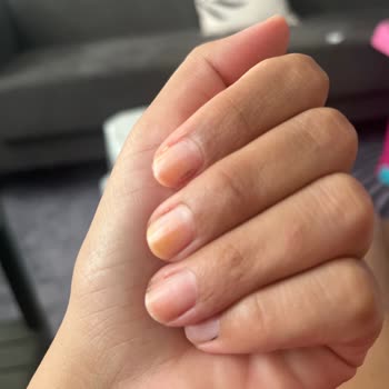 Flormar Oje Tırnaklarımda Kalıcı Sarılığa Sebep Oldu