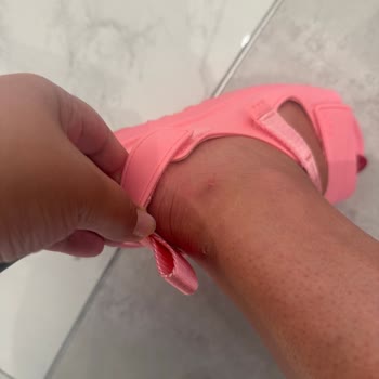 İlk Kullanımda Ayağımı Parçalayan Sandalet Ve Mağazanın İlgisizliği