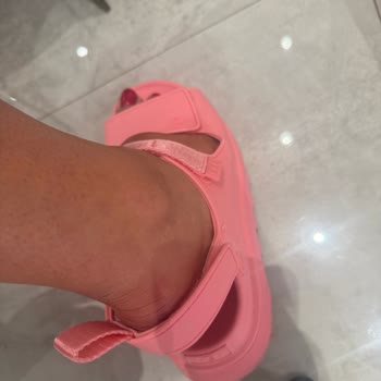 İlk Kullanımda Ayağımı Parçalayan Sandalet Ve Mağazanın İlgisizliği