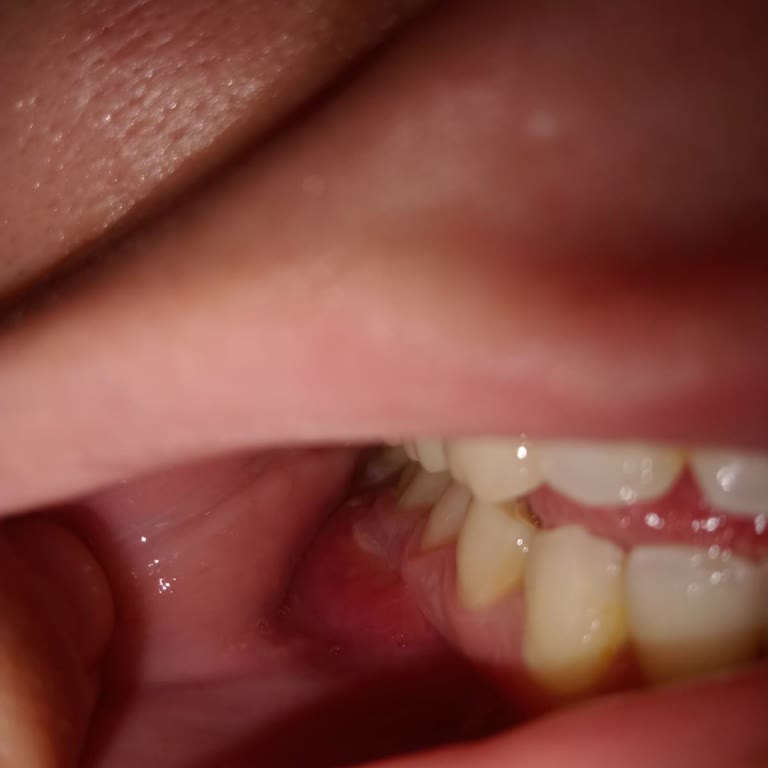 Diş Dolgusu Sonrası Yaşadığım Hayal Kırıklığı Ve Acı