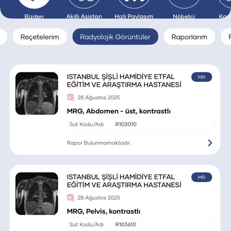 Radyoloji Raporlarının Gecikmesi Sağlık Durumumu Tehlikeye Atıyor